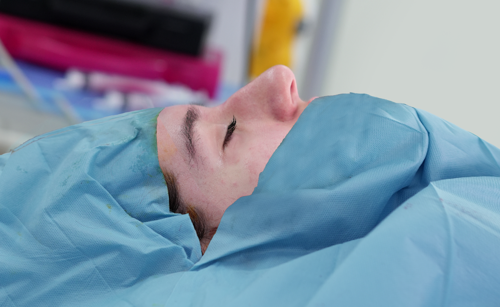 Rhinoplasty